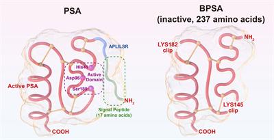 The role of prostate-specific antigen in the osteoblastic bone metastasis of prostate cancer: a literature review